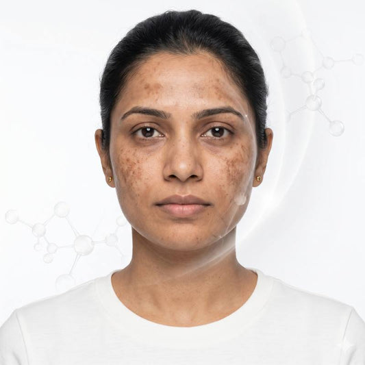 TXA 5X Brightening Cream