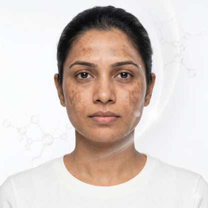 TXA 5X Brightening Cream